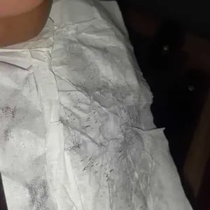 Allphv Penghilang Komedo Hidung Step1 & Step2 Set NA11240200141 NA11240100476 Masker Serum Skincare Wanita Pria