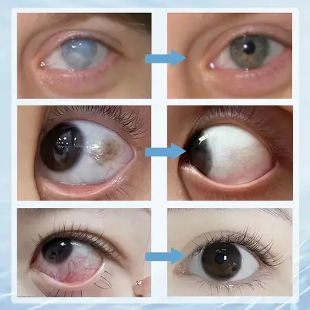 Lutein Perawatan mata Meredakan Kelelahan Mata/Tetes Mata Lutein/Mata Kering Dan Mata Astringen Presbyopia Eye Drops Relieve Eye Fatigue And Relieve Dry Eyes. 2