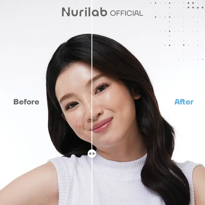 [TWIN PACK] Nurilab - Acne ConclearingTM Spot Drying Lotion 2.5g Obat Totol Jerawat 4