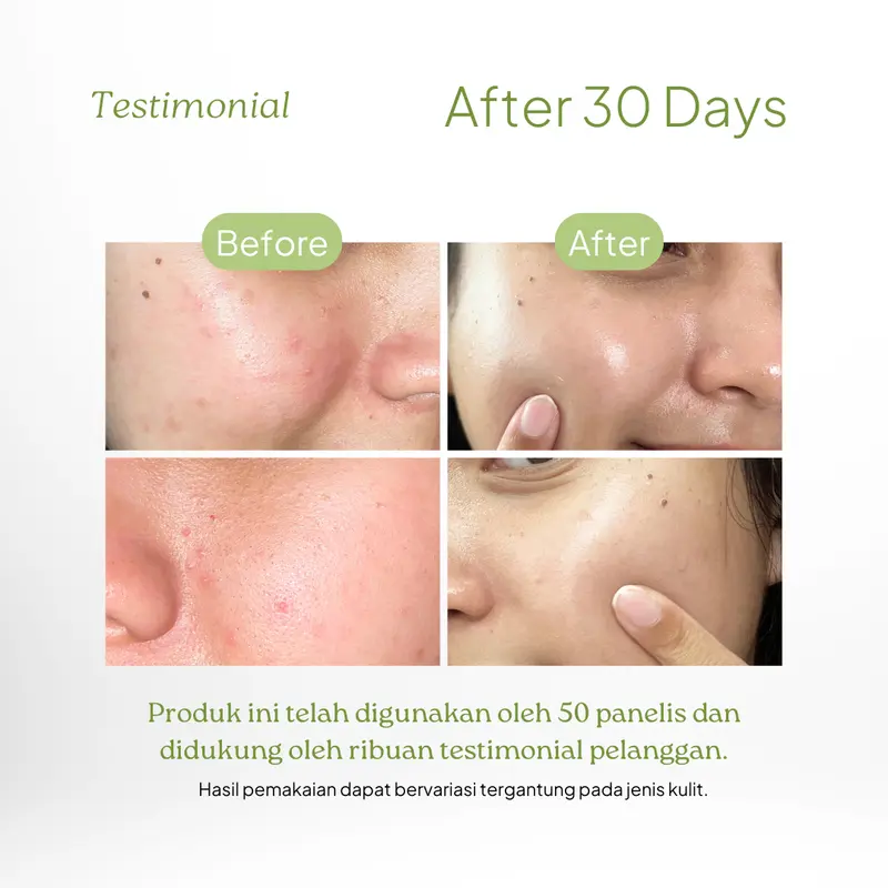 Dorskin Multifungsi Matcha Glow Dream Mask Moisturizer - 3in1 Pelembap Sleeping Mask dan Obat Totol Jerawat dengan Centella Asiatica dan Arbutin 1