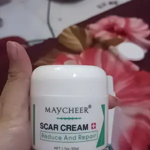 Penghilang bekas luka hitam koreng penghilang bekas luka anak salep penghilang bekas luka hitam 50g obat penghilang bekas luka menghilangkan bekas luka bekas obat keloid luka di kaki keloid bekas luka bakas dan stretch mark Bekas Luka Luka Jahitan Bekas