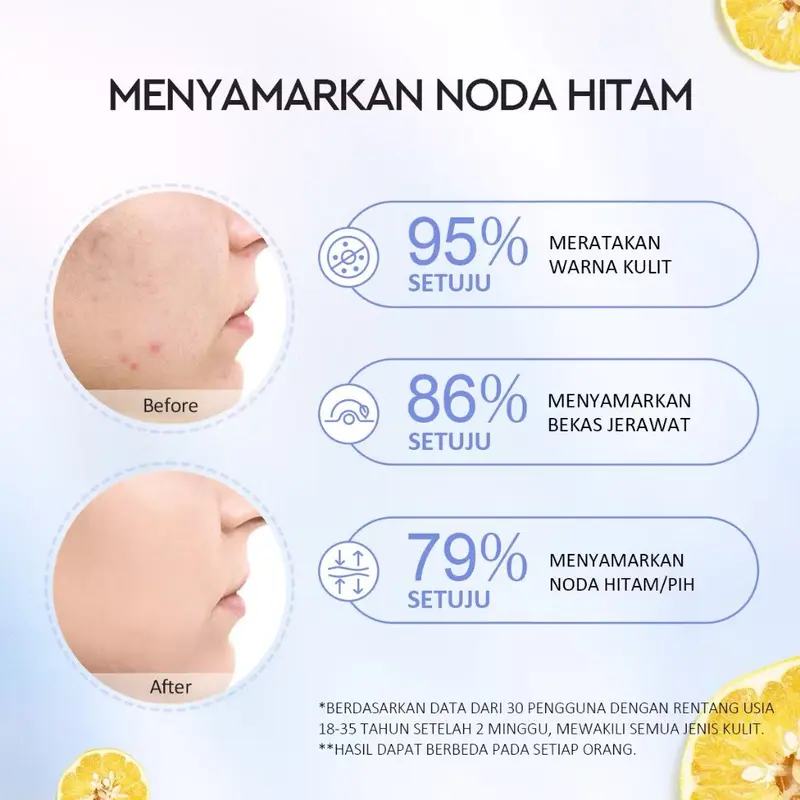 Glad2Glow Yuja Symwhite 377 Dark Spot Moisturizer menghilangkan bekas jerawat diwajah 2
