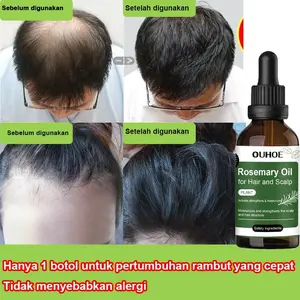 Rosemary hair oil hair tonic penumbuh rambut dengan cepat dan botak tebal serum rambut rontok Hair growth serum Minyak