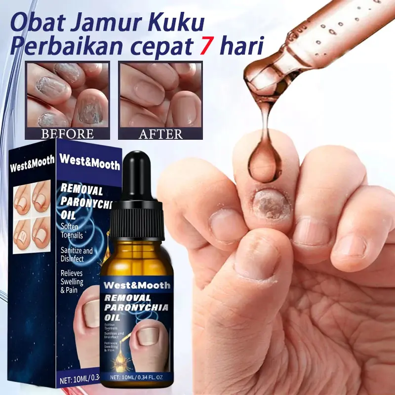Obat Jamur Kuku Paling Ampuh Nail Repair Essence Serum Ajaib Viral Di Mengobati Kuku Berjamur Dan Rusak Vitamin Kuku Kering Dan Rusak Perawatan Kuku Obat Cantengan Nail
