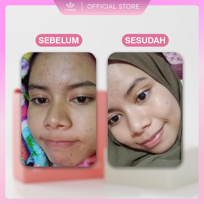HIQWEEN RETINOL BRIGHTENING SOAP Face Facial Wash Sabun Cuci Muka Badan Retinol Memutihkan Arbutin Kotoran Membersihkan Mencerahkan Wajah Hitam 2