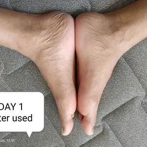 RtopR【BPOM】Foot Peeling Mask Masker Kaki /Pelembab Pengelupasan kulit Pedikur Pembaharuan Menghilangkan Kulit Mati Kaus Kaki Tumit Mengupas Perawatan Kaki