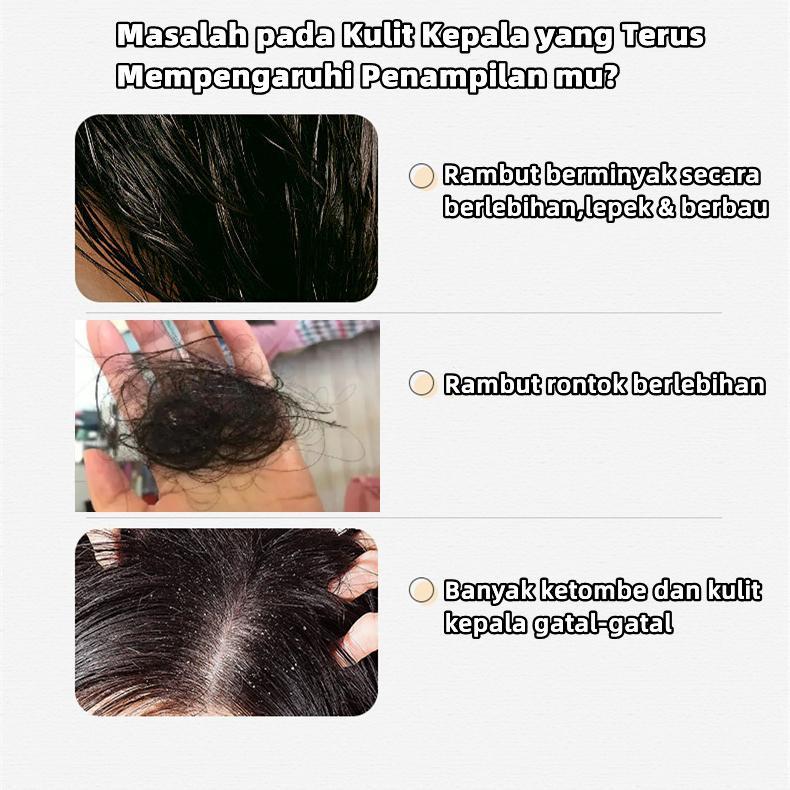 Product Introduction of Vivida Anti Hair Fall Hair Treatment Shampoo Oil Control Anti- 300ml 20