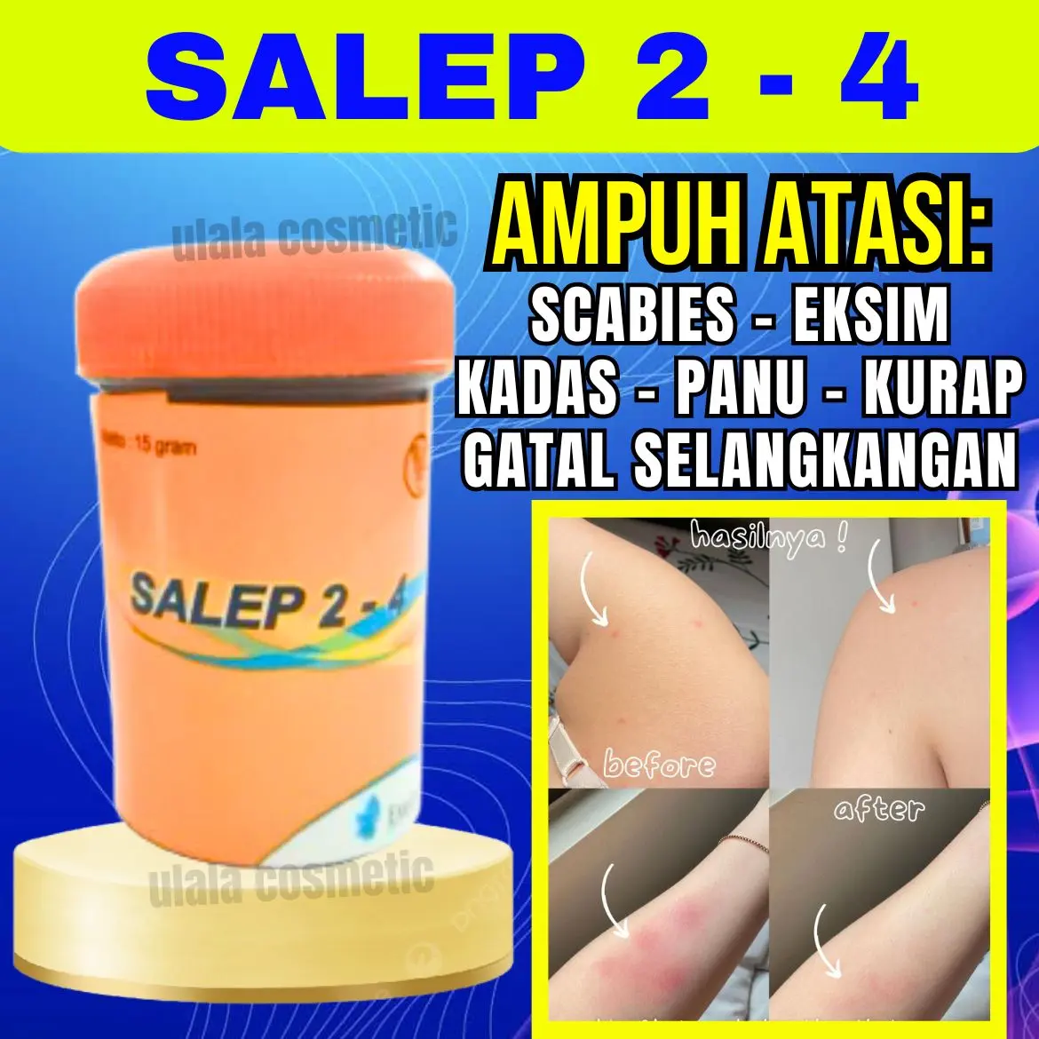 SALEP 24 / 2-4 15GR | NUFARINDO | ZWAFEL | OBAT KADAS | KUDIS | KUTU AIR | GATAL | ZWAVEL / Salep Zwafel 24 Original Gatal Scabies - Salep Gatal 2-4 Nufarindo Asli Ampuh