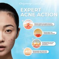 Gambar [BPOM] Oilyoung Triple Active Anti Acne Serum 10g - Salicylic Acid Acne Drying Lotion Serum Jerawat Acne Treatment Wajah Berjerawat Extract - 1 Botol dari Oilyoung Indonesia Kab. Tangerang 3 Tokopedia