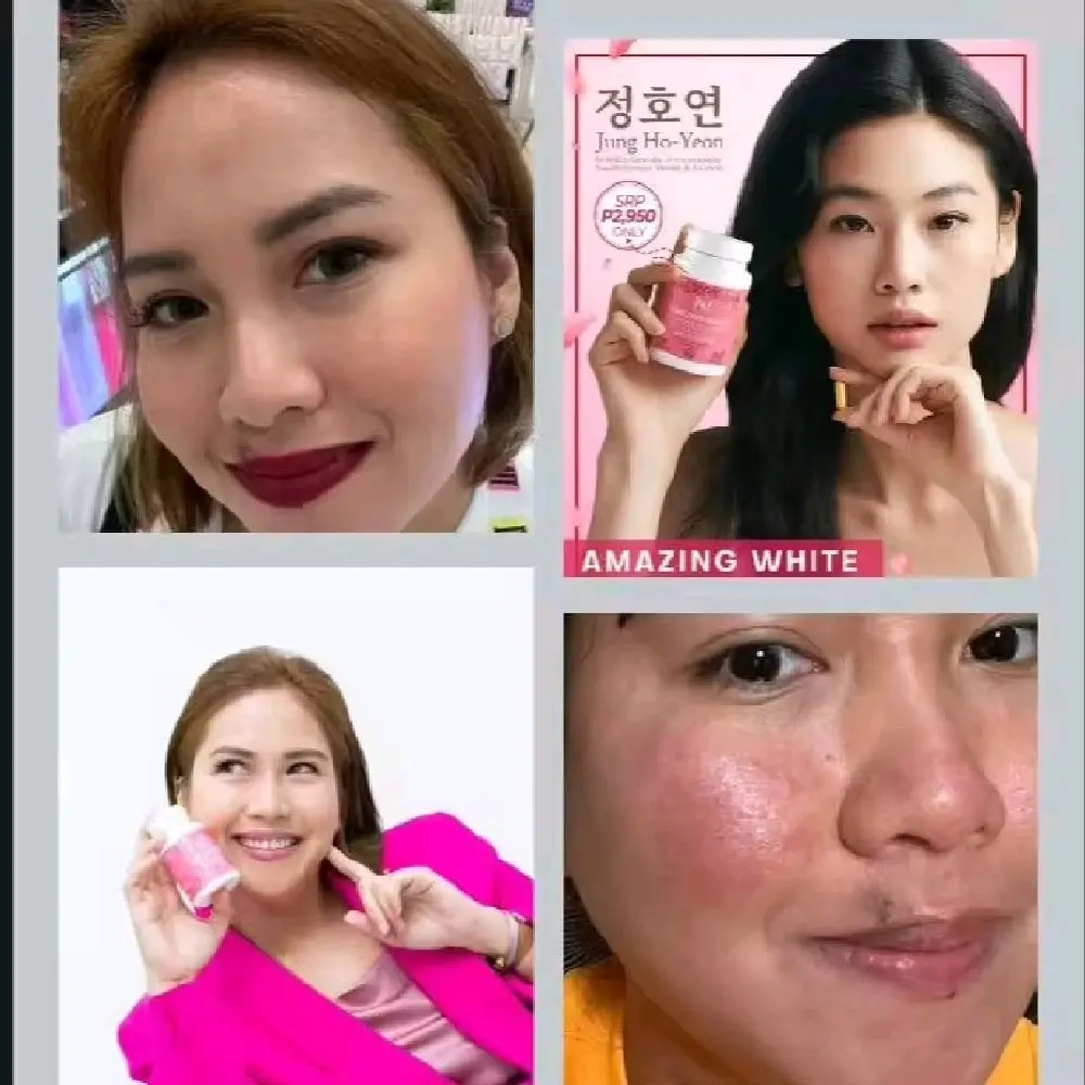 I AM Amazing White Glutathione Beauty Supplements
