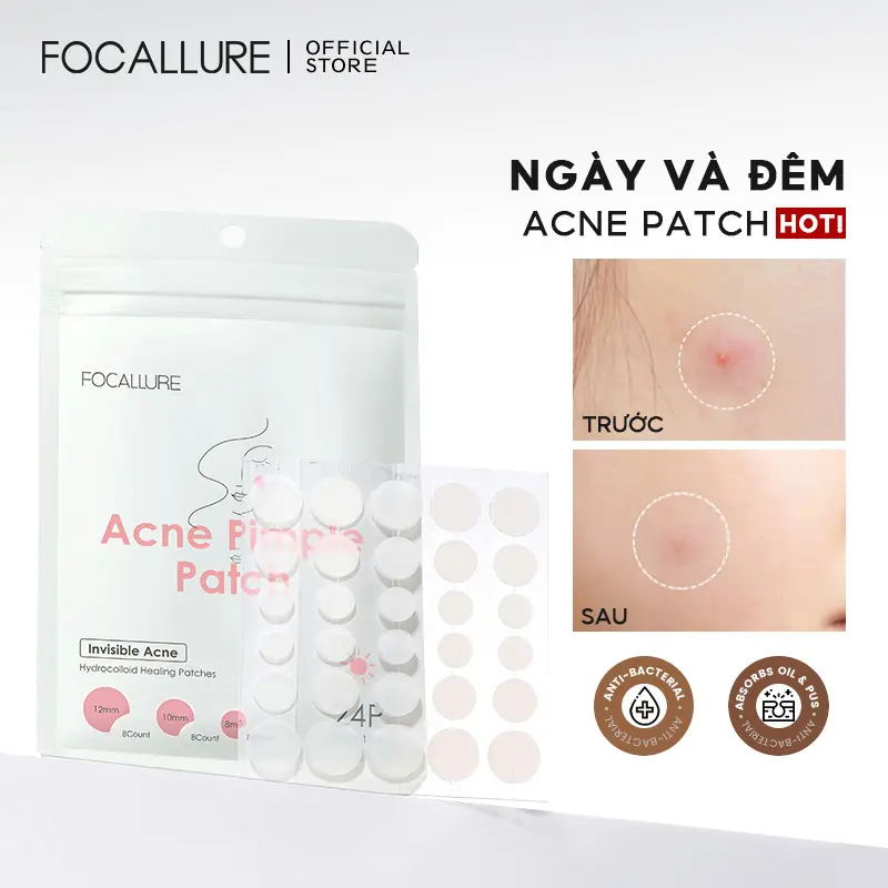 Miếng Dán Đốm, FOCALLURE, Điều Trị Mụn Trứng Cá, Điều Trị Mụn Trứng Cá, Chăm Sóc Da, Phục Hồi Mụn Trứng Cá