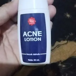 Viva Acne Lotion PM 30 ml