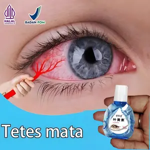 Berlemak Kekuningan Penyakit Pterigium Glukoma Katarak Ada Selaput di Bagian Putih Bola Mata Pinguace Lemak Mata Herbal Oil