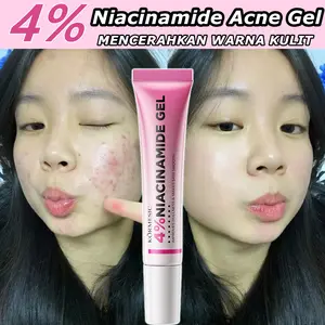 Niacinamide Gel Acne Gel Treatment Mengatasi Jerawat Kemerahan Bengkak Dan Bernanah Penghilang Flek Hitam Pemutih Pelembab Kulit Perawatan Kulit Wajah Berjerawat Dengan Kandungan 4% Niacinamide Merawat Kulit
