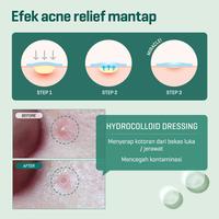 Gambar SOME BY MI 30 Days Miracle Clear Spot Patch / Pimple Patch dari SOME BY MI SHOP Kota Tangerang 5 Tokopedia