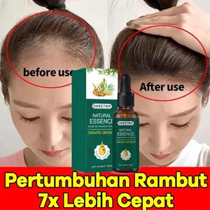 Natural Beard Oil Serum Penumbuh Rambut Cepat Dan Tebal Menyehatkan Kulit Kepala&Meningkatkan Regenerasi Rambut - Penumbuh rambut botak ampuh - Obat penumbuh rambut  Ginger Germinal Oil Brewok Jenggot