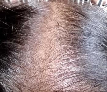 Product Review of [ BISA COD ] PAKET 5 PCS 145RB HAIR TONIK PENYUBUR RAMBUR ANTI HAIRFALL from e**8 2