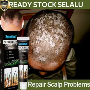 Sumifun Obat Ketombe rambut Anti itching cream 20g Obat Psoriasis di Kepala Eksim Kepala gatal