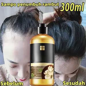 Shampo Penumbuh Rambut Cepat Ginger Shampoo 300ml Pertumbuhan Rambut Pengendalian Minyak Anti Rambut Rontok Botak Sampo Anti Ketombe Dan Rontok Anti Hair Fall Hair Treatment Mengurangi Rambut Rontok Perawatan Haircare