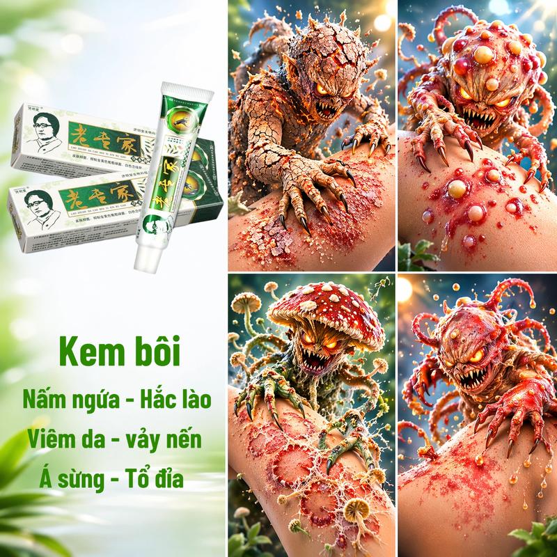 (Xanh lá) Kem bôi thảo mộc chuyên á sừng, viêm da, nứt nẻ chân tay...