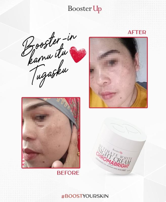 BoosterUp Ultimate Plus Paket Flek & Anti Aging Exfoliating 7