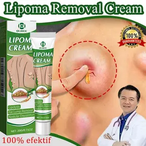 Lipoma Cream Obat Benjolan Subkutan Lipoma Removal Cream Obat Salep Benjolan Lipoma Ampuh Herbal salep Lipoma Salep