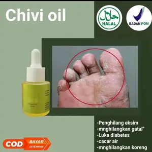 CHIVIOIL PENGHILANG BEKAS LUKA EKSIM DAN GATAL GATAL