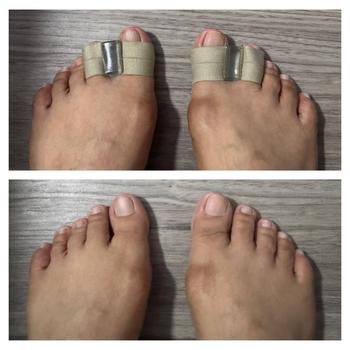 Product Review of New Silicone Two Toe Separator Foot Care Adjuster Thumb Finger Correction Tool Straightener Toe Spreader from J**1 0