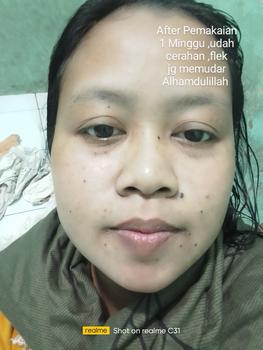 Product Review of SIMPLE PREMIUM SET - Paket Pencerah Wajah from G**i 1