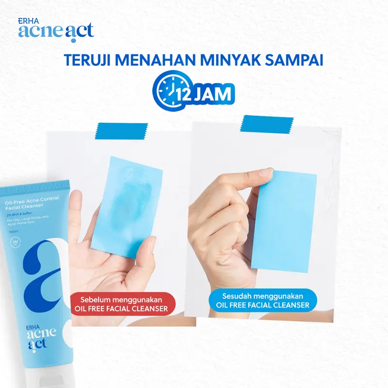 ERHA AcneAct Oil-Free & Acne Control Cleanser - Sabun Wajah Jerawat Berminyak 1