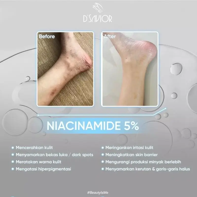 D'SAVIOR Body Serum Brightening Niacinamide 5% Ukuran Travel 50ml - Mencerahkan Memudarkan Bekas Luka 1
