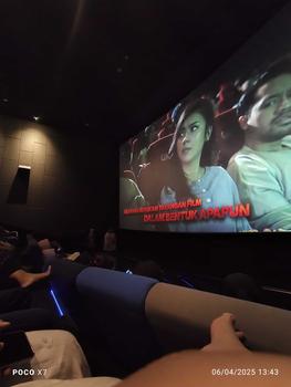 Product Review of sarung jempol gaming ff pubg genshin ML dll berbagai macam game 1 pasang kiri kanan bagus untuk jempol yang berminyak from P**e M**h K**n 0