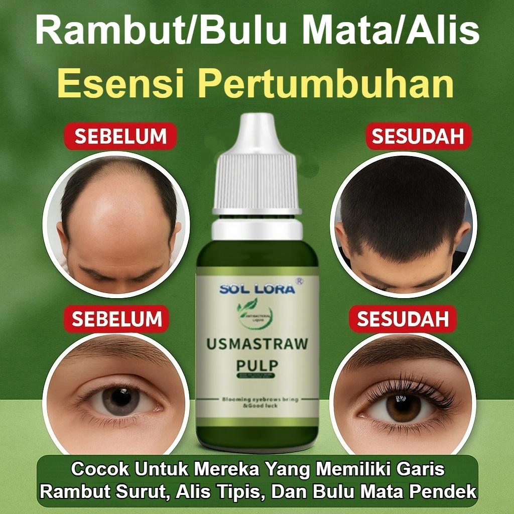 Herbal Hair Growth Tonic/Jus Penumbuh Rambut Usma Serum Herbal Penumbuh Rambut Bulu Mata Alis Rambut Serum Penumbuh Rambut Anti Kebotakan Menebalkan Rambut Mempercepat Pertumbuhan Rambut Herbal Hair Growth Tonic/Jus Penumbuh Rambut Usma Serum Herbal Penumbuh Rambut Bulu Mata Alis Rambut Serum Penumbuh Rambut Anti Kebotakan Menebalkan Rambut Mempercepat Pertumbuhan Rambut
