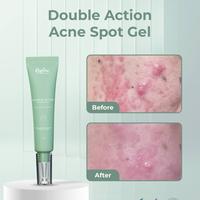 Gambar [Promo] Reglow Acne Spot Gel | Obat Totol Jerawat Cepat Kering | Redakan Kemerdehan, Bekas Jerawat & Bikin Kulit Lebih Halus Tanpa Iritasi dari Reglow Beauty Skin Id Kab. Bantul 4 Tokopedia