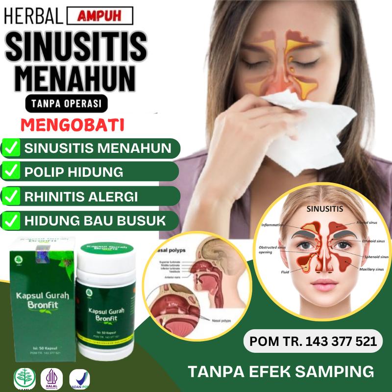Kapsul BronFIT Obat Sinusitis Paling Ampuh Flu Polip Hidung Bersin ...