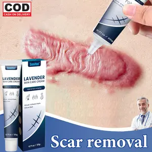 Penghilang bekas luka Scar Remover Cream 20g penghilang bekas luka keloid salep Lama Hitam Koreng Salep penghilang bekas luka, keloid, dan tanda regangan ampuh