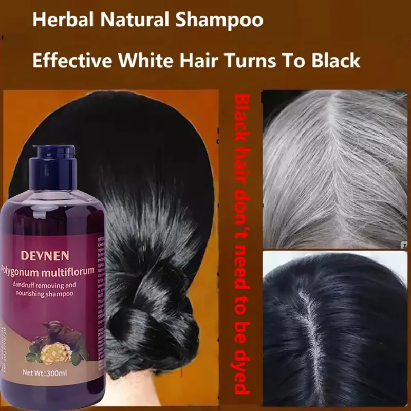 SHAMPO Black Herbal Natural Penyamar Rambut dan Penghiang uban Usia Muda 300ml Shampoo Herbal Polygonum Penghitam Rambut Hitam Dalam Sampo Ketombe Sampo Menghitamkan  Conditioner 0