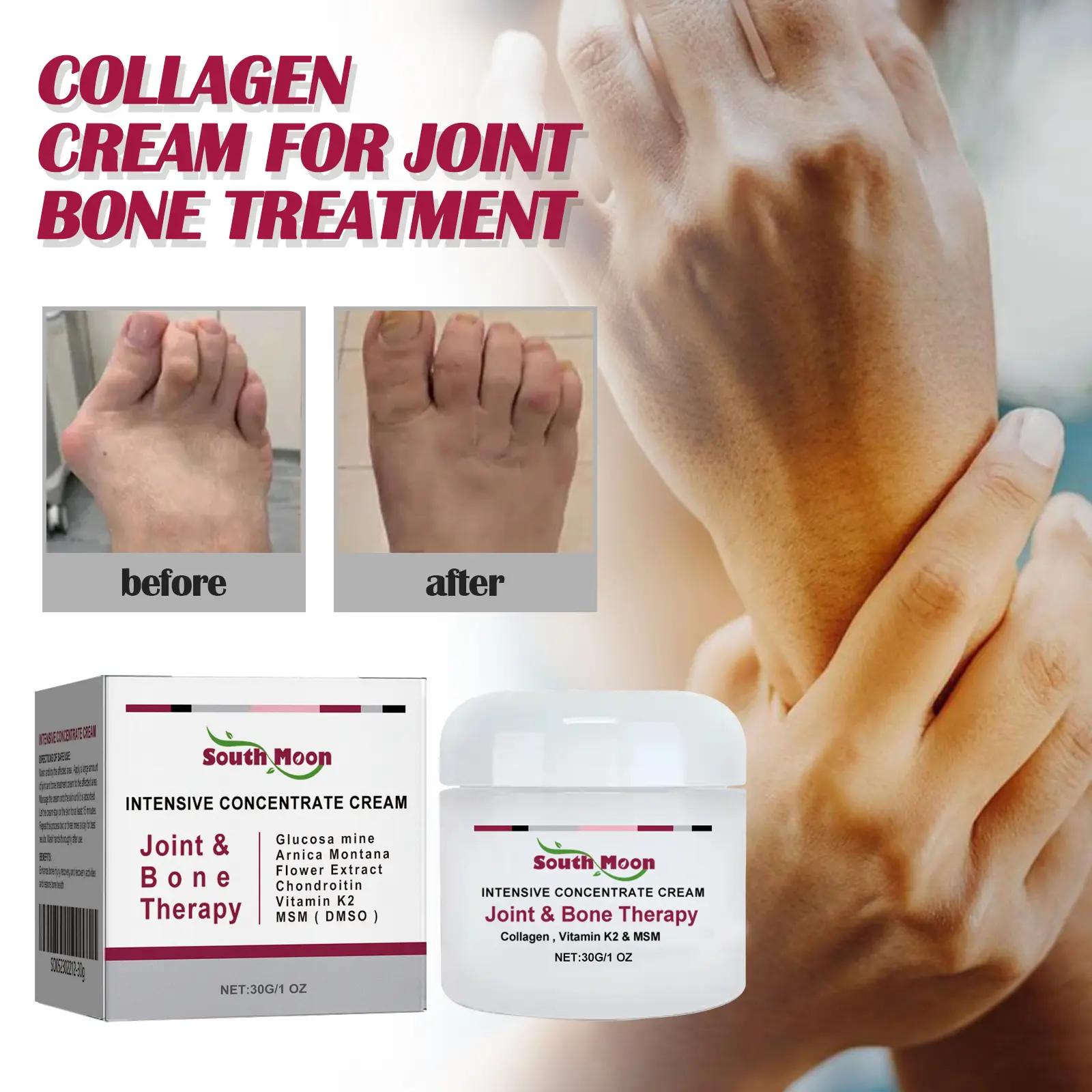 Intensive Concentrate Cream Joint Bone Therapy Cream Joint&Bone Therapy Reduce Soreness Therapys 30g Krim Pengobatan Asam Urat Sendi Perfectx Terapi Sendi Dan Tulang Pereda Nyeri Utut