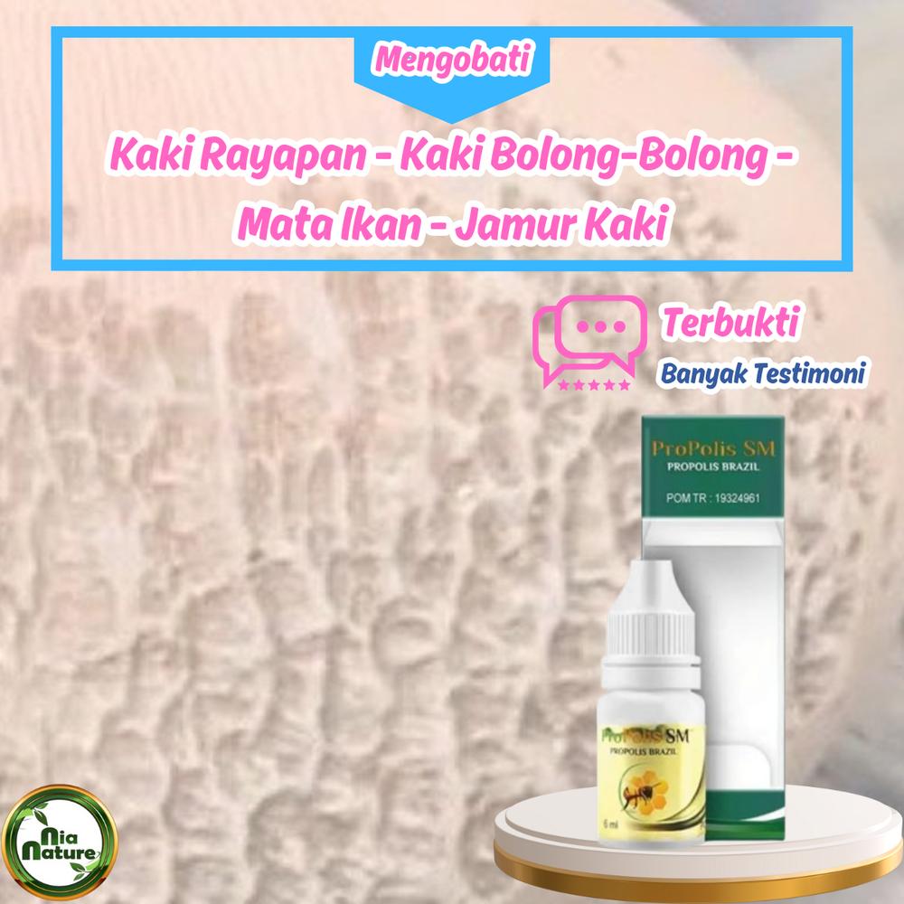 Obat Kaki Rayapan Bolong-Bolong Jamur Kaki Bau Mata Ikan Kaki Jamuran - Propolis SM Foot