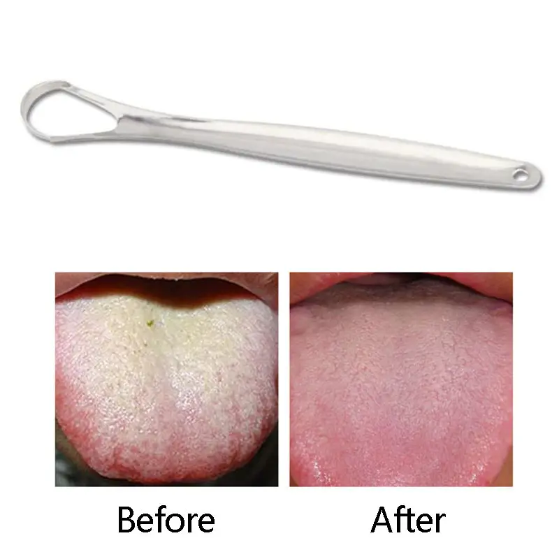 PEMBERSIH LIDAH TONGUE ORAL SCRAPER CLEANER STAINLESS STEEL L013 SILVER 1