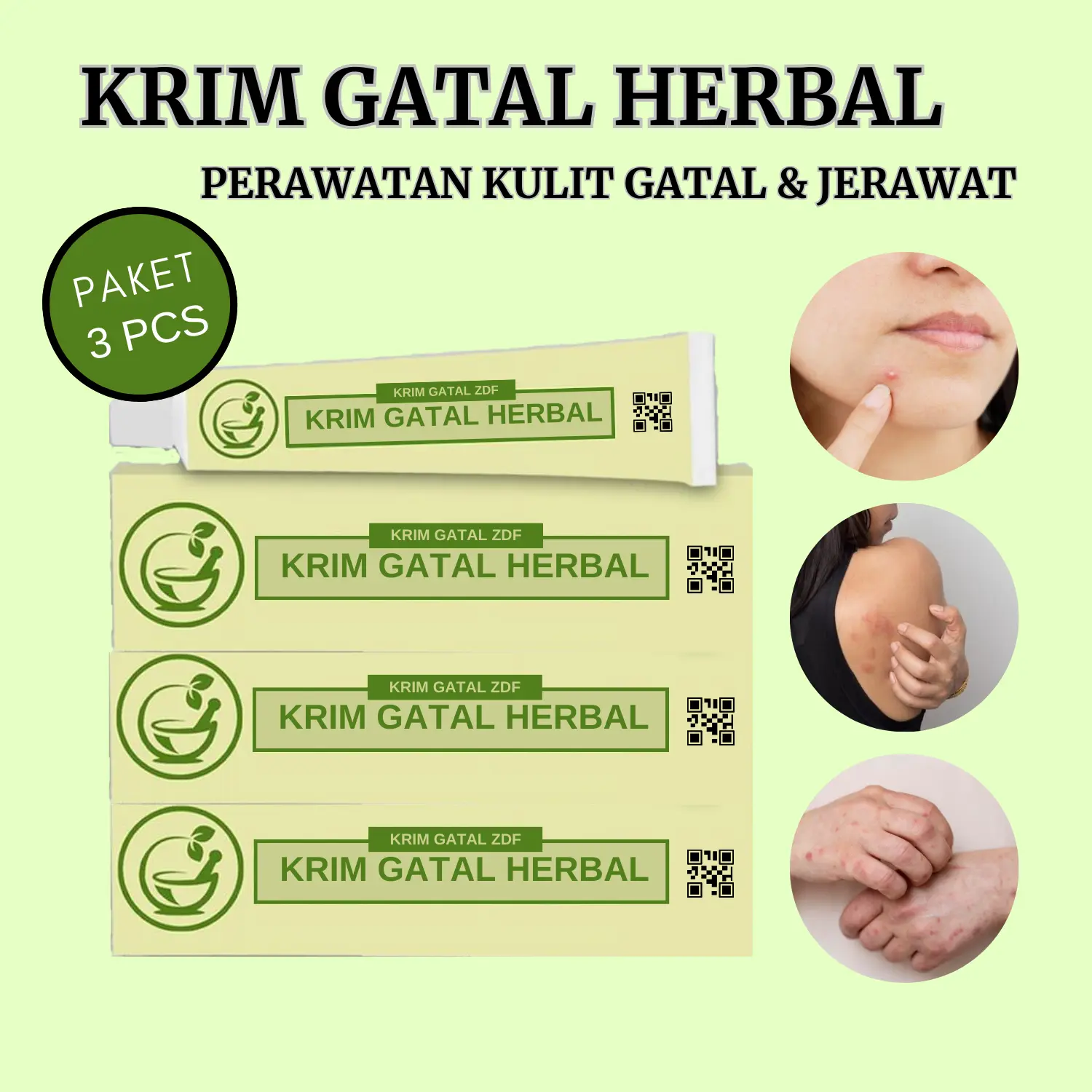 [Original] Promo 3pcs Krim Gatal Herbal Untuk Perawatan Kulit Gatal dan Wajah Jerawat