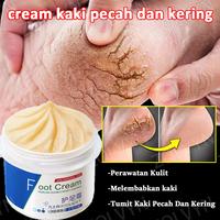 Gambar cream kaki pecah dan kering krim kaki foot cream krim kaki obat kaki pecah pecah tumit kaki pecah dan kering - 1 PCS dari ZOLVYN Kab. Bogor 1 Tokopedia