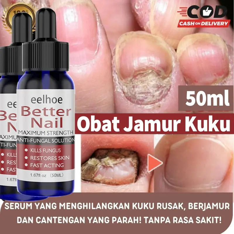 Obat Jamur Kuku Obat kuku jamur dan rusak Nail Repair Essence Serum Memperbaiki Kuku Rusak Penghilang Jamur Kuku Gel Gel Anti Infeksi Obat Kuku Rusak Busuk Berjamur Infeksi kuku Jempol Obat Cantengan Jempol Kaki Obat Kuku Bengkak Kuku Kaki Obat Paron