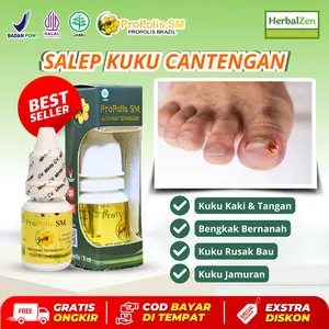 obat Salep Kuku Cantengan Jempol Kuku Kaki Tangan Bengkak Bernanah Rusak Bau Kuku Jamuran Propolis SM Nail Wanita