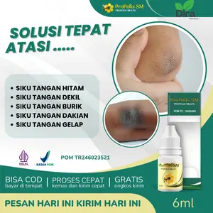 Propolism SM Herbal Mengatasi Siku Tangan Hitam, Gelap Burik, Dekil, Dakian, Mata Kaki Hitam