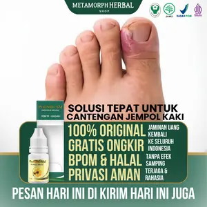Propolis SM Herbal Mengatasi Kuku Cantengan, Kuku Jempol Kaki Bengkak Berdarah dan Bernanah, Kuku jamuran, Kuku Rusak dan Bau, Kaki Cantengan, Pengering Luka Cantengan 100% Ekstrak Propolis Brazil asli Nail Hitam Perawatan Kutek