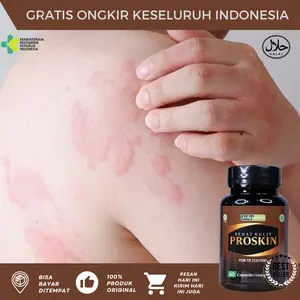 Biduran Dan Gatal Gatal, Gatal Biduran Kapsul, Alergi Dingin, Gatal Seluruh Tubuh, Kaligata Menahun, Alergi Cuaca