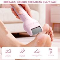 Gambar Enchen Rock 2 Set Perawatan Kulit Kaki-Penghalus Pengikis Tumit Kaki/ Penghalus Kaki Elektrik Untuk Kulit Mati Dan Kapalan / Electric Callus Remover Pedicure Menicure - Pink dari ENCHEN PERSONAL CARE Kab. Tangerang 4 Tokopedia