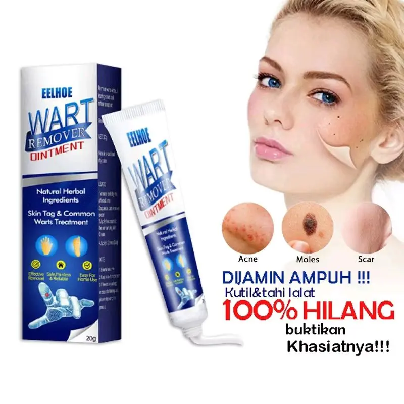 Cream Penghilang Tai Lalat Kutil Ampuh Wart Remover Skin Tag Oitment 2