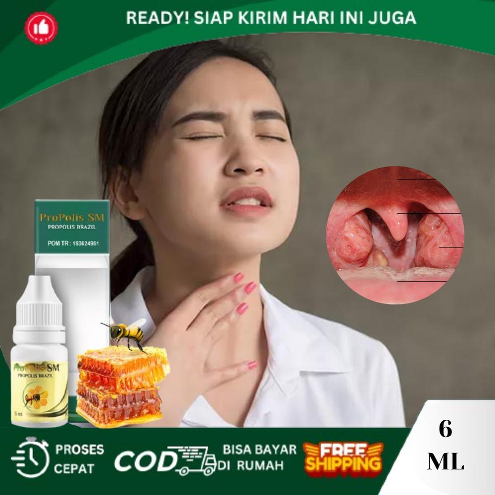 Penghancur Amandel Obat Amandel Dewasa Bengkak Radang Tenggorokan Amandel Bengkak Sakit Nelen Untuk Anak Dan Dewasa erasi Dengan ProPolis SM